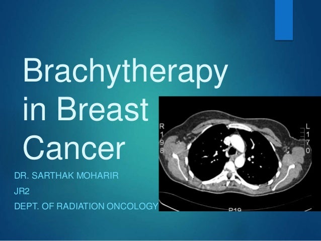 breast cancer brache therapy Breast cancer brache therapy